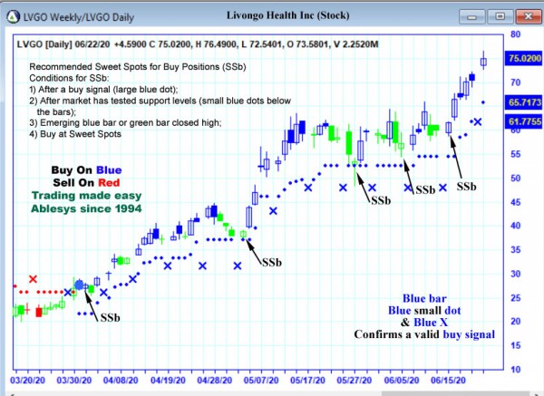 AbleTrend Trading Software LVGO chart